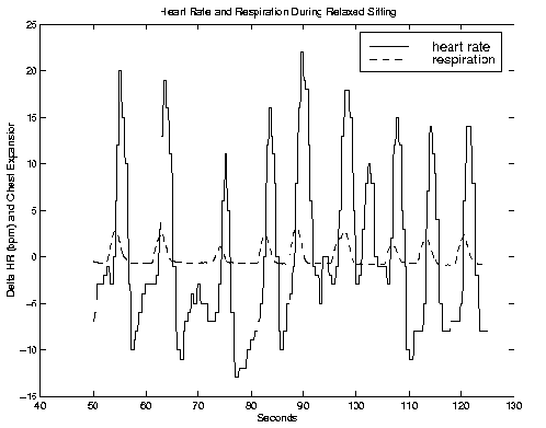\begin{figure}\centerline{\psfig{figure=/v/projects/AC/jen-pics/hrrespdata.eps,width=85truemm}}
\end{figure}