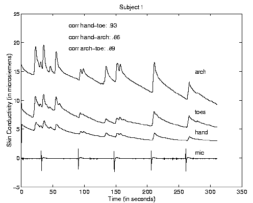 \begin{figure}\centerline{\psfig{figure=/v/projects/AC/jen-pics/gsrhtdata.eps,width=85truemm}}
\end{figure}