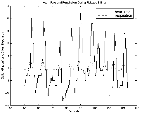 \begin{figure}\par\centerline{\psfig{figure=/v/projects/AC/jen-pics/iswc97/hrrespdata.eps,width=85truemm}}
\par\end{figure}