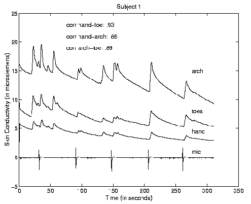 \begin{figure}\centerline{\psfig{figure=/v/projects/AC/jen-pics/gsrhtdata.eps,width=85truemm}}
\end{figure}