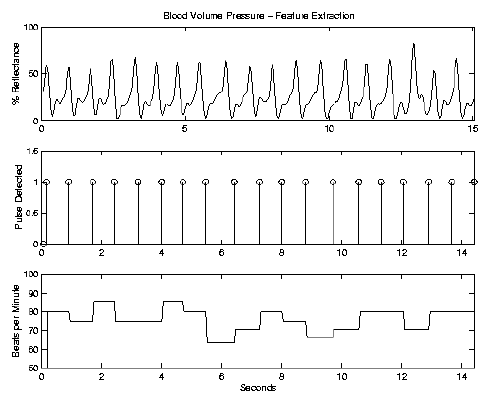 \begin{figure}\centerline{\psfig{figure=/v/projects/AC/jen-pics/volvo/bvprmbs.ps,width=85truemm}}
.\end{figure}